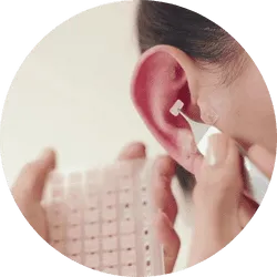 Auriculoterapia